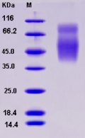 Recombinant Rat CD86 / B7-2 Protein (His tag)