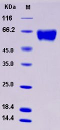 Recombinant Rat GFRA1 / GFR alpha-1 Protein (His tag)