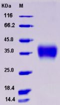 Recombinant Rat CD32b / FCGR2B Protein (His tag)
