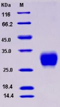 Recombinant Rat CD16a / FCGR3A Protein (His tag)