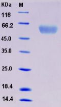 Recombinant Rat KIM-1 / TIM1 / HACVR1 Protein (His tag)