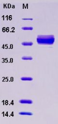 Recombinant Rat GPT2 Protein (His tag)