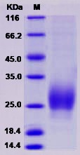 Recombinant Rat CTLA-4 / CD152 Protein (ECD, His tag)